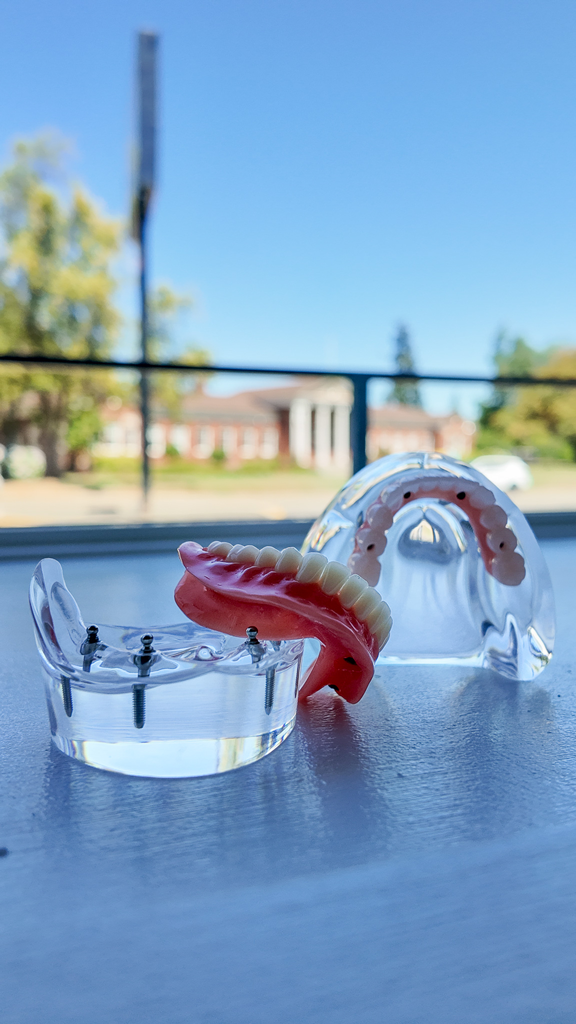 All on four complete implant retained denture models on a sunny day