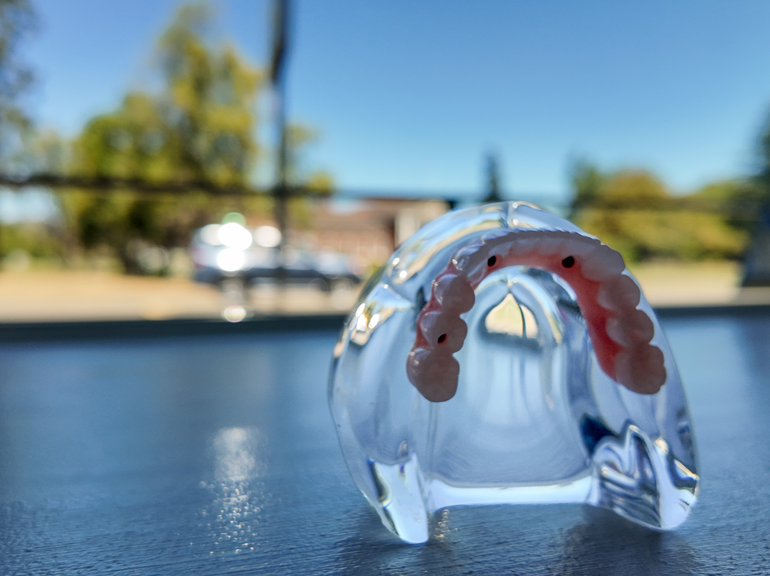 Clear dental model of implant retained upper dentures with outdoor background of picture window in the front office of Cascade Denture Center